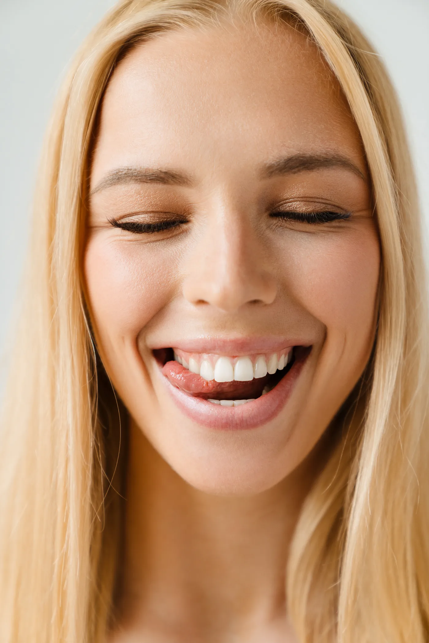 Sourire d'une patiente adulte après traitement orthodontique